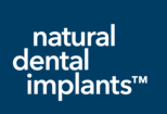 Natural Dental Implants AG